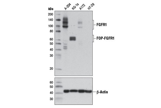  Image 3: PhosphoPlus® FGF Receptor 1 (Tyr653/654) Antibody Duet