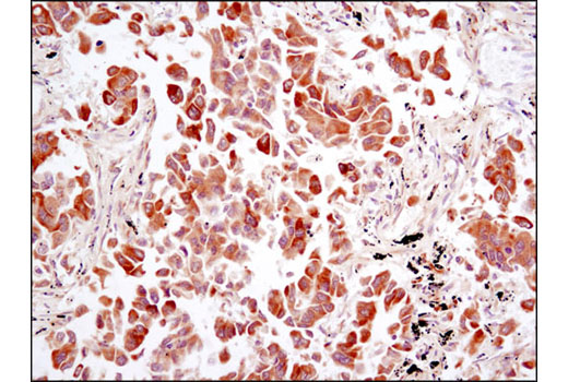  Image 28: Angiogenesis Receptor Tyrosine Kinase Antibody Sampler Kit