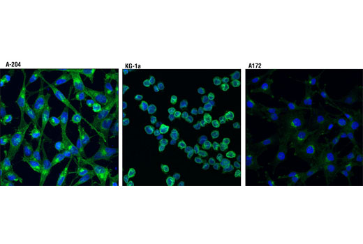 Immunofluorescence Image 1: FGF Receptor 1 (D8E4) XP®Rabbit mAb