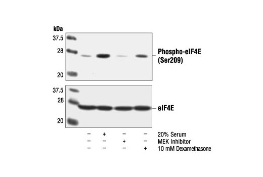 Western Blotting Image 1: Phospho-eIF4E (Ser209) Antibody