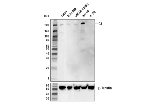 Western Blotting Image 1: Complement C3 Antibody