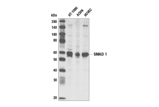 Western Blotting Image 1: SMAD1 Antibody