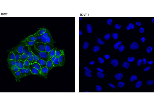 Immunofluorescence Image 1: IGF-I Receptor β (D23H3) XP®Rabbit mAb