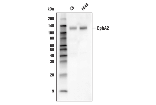 Western Blotting Image 1: EphA2 (D4A2) XP® Rabbit mAb (Biotinylated)