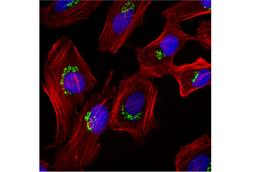 Immunofluorescence Image 1: Golgin-97 (CDF4) Mouse mAb