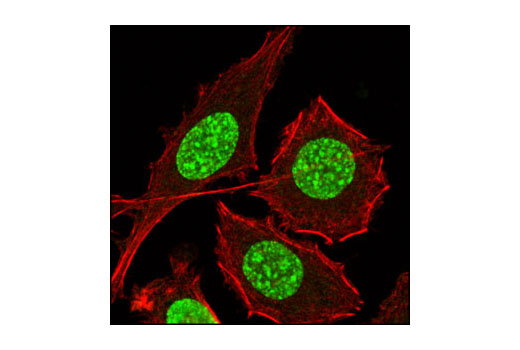 Immunofluorescence Image 1: Tri-Methyl-Histone H3 (Lys9) Antibody