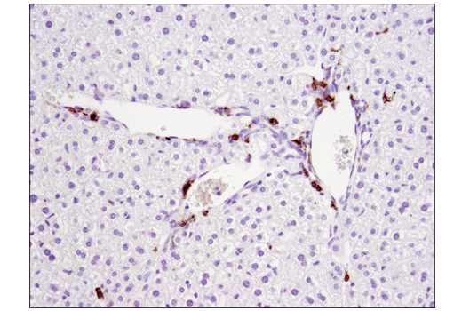 Immunohistochemistry Image 3: CD11c (D1V9Y) Rabbit mAb