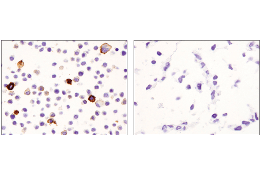 Immunohistochemistry Image 5: CD11c (D1V9Y) Rabbit mAb