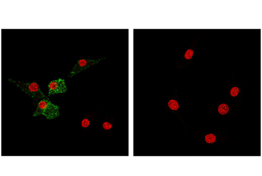 Immunofluorescence Image 2: CD11c (D1V9Y) Rabbit mAb