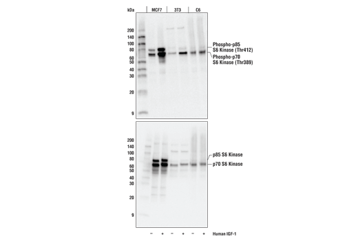  Image 22: Phospho-Tau (Ser214/T217) Signaling Antibody Sampler Kit