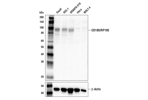 Western Blotting Image 1: CD180/RP105 Antibody