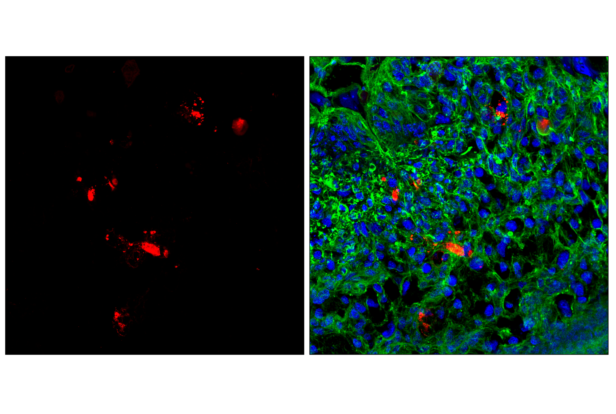 Immunofluorescence Image 1: Granzyme F (E2U7L) Rabbit mAb (Alexa Fluor® 647 Conjugate)