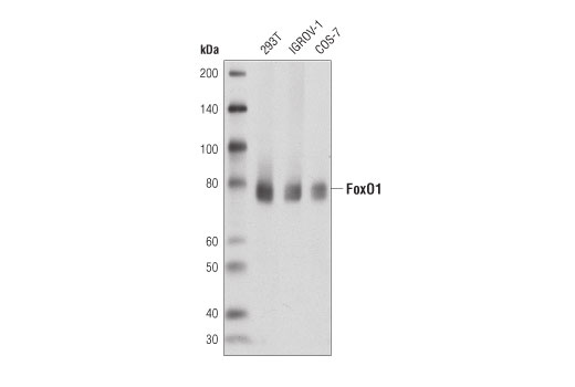 Western Blotting Image 1: FoxO1 (D8T1S) Mouse mAb