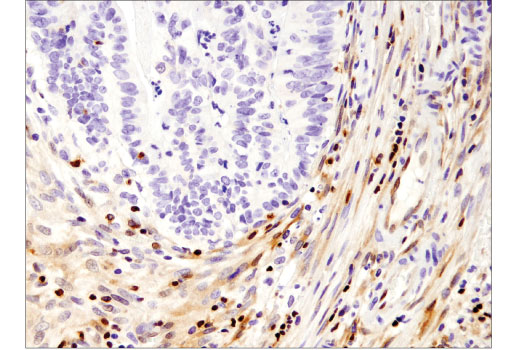 Immunohistochemistry Image 2: FoxO1 (D8T1S) Mouse mAb