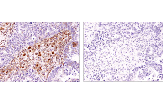 Immunohistochemistry Image 5: FoxO1 (D8T1S) Mouse mAb