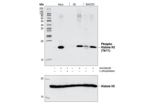Western Blotting Image 1: Phospho-Histone H3 (Thr11) Antibody