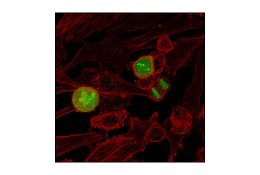 Immunofluorescence Image 1: Phospho-Histone H3 (Thr11) Antibody