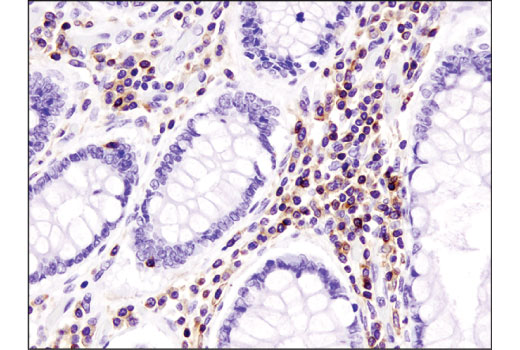 Immunohistochemistry Image 1: CXCR4 (D4Z7W) Rabbit mAb (IHC Specific)