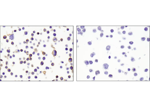Immunohistochemistry Image 2: CXCR4 (D4Z7W) Rabbit mAb (IHC Specific)