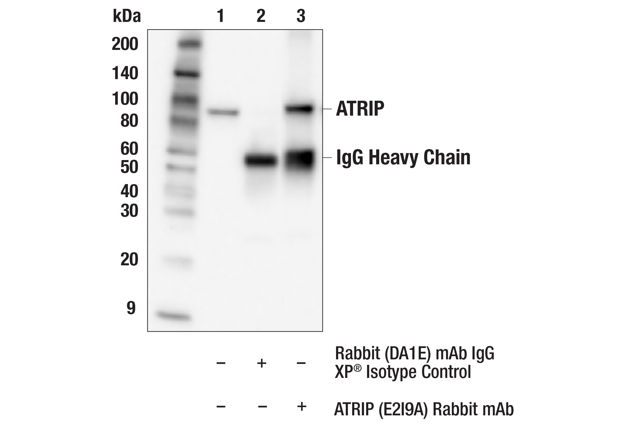 Immunoprecipitation Image 1: ATRIP (E2I9A) Rabbit mAb