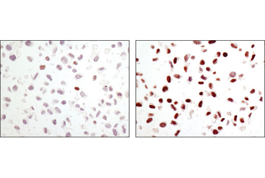 Immunohistochemistry Image 4: Phospho-c-Jun (Ser63) (54B3) Rabbit mAb (BSA and Azide Free)