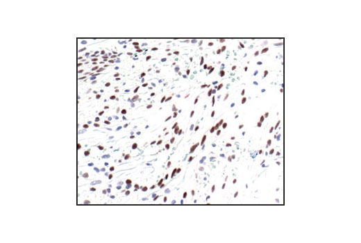 Immunohistochemistry Image 5: Phospho-c-Jun (Ser63) (54B3) Rabbit mAb (BSA and Azide Free)