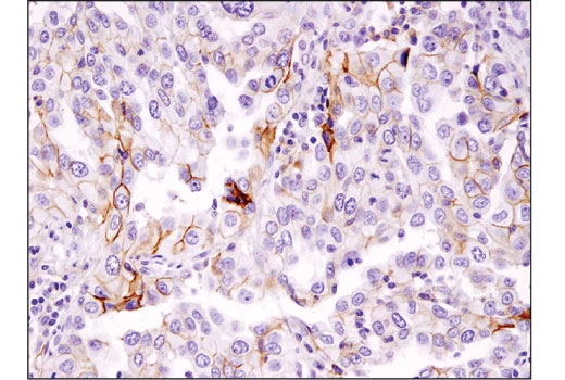 Immunohistochemistry Image 1: MRP1/ABCC1 (D5C1X) Rabbit mAb (BSA and Azide Free)