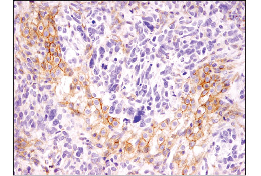 Immunohistochemistry Image 2: MRP1/ABCC1 (D5C1X) Rabbit mAb (BSA and Azide Free)
