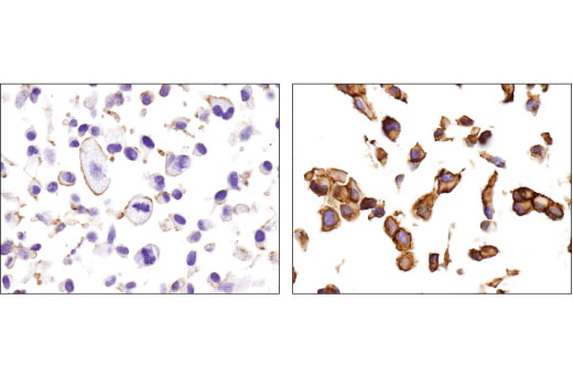 Immunohistochemistry Image 3: MRP1/ABCC1 (D5C1X) Rabbit mAb (BSA and Azide Free)