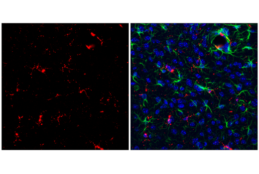 Image 1: Mouse Microglia Marker IF Antibody Sampler Kit