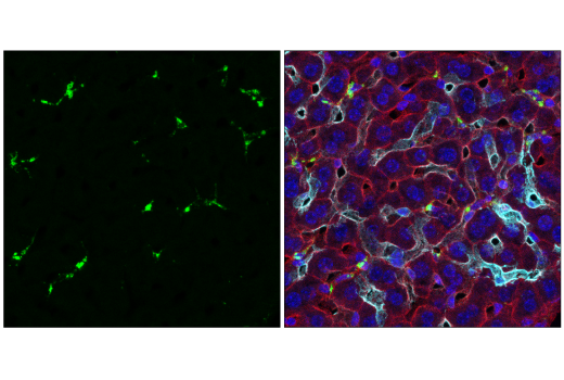  Image 3: Mouse Reactive M1 vs M2 Macrophage IHC Antibody Sampler Kit