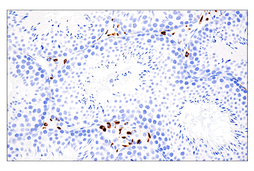 Immunohistochemistry Image 4: CD68 (E3O7V) Rabbit mAb