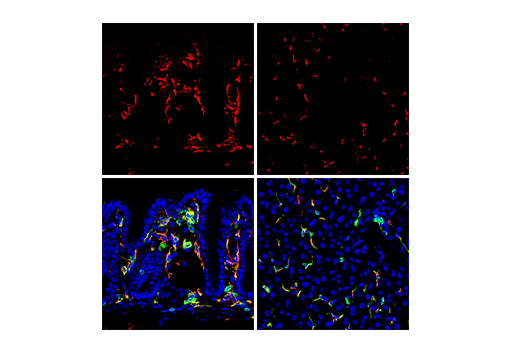 Immunofluorescence Image 3: CD68 (E3O7V) Rabbit mAb