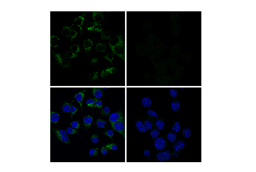 Immunofluorescence Image 4: CD68 (E3O7V) Rabbit mAb
