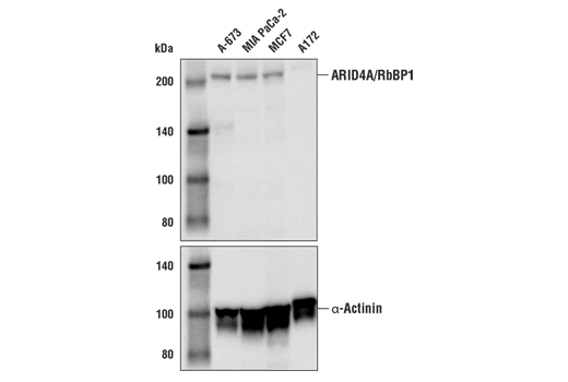 Western Blotting Image 1: ARID4A/RbBP1 Antibody