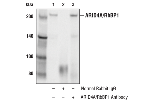 Immunoprecipitation Image 1: ARID4A/RbBP1 Antibody