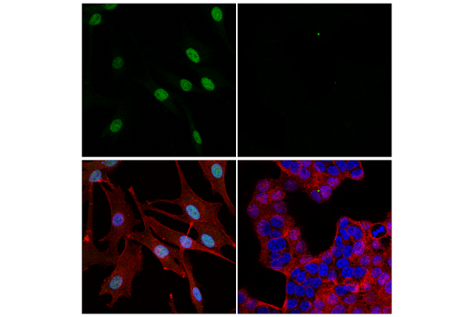 Immunofluorescence Image 1: MITF (D3B4T) Rabbit mAb