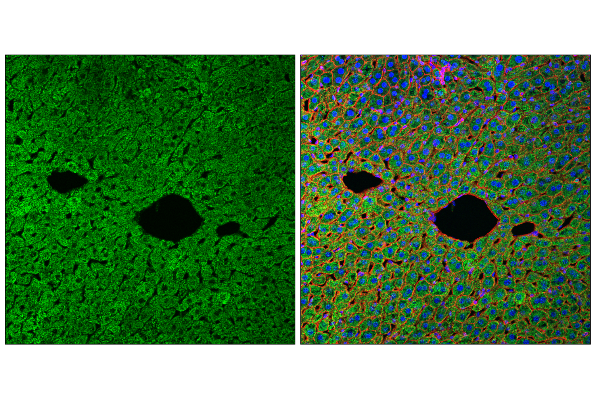 Immunofluorescence Image 1: SLC25A1 (E7B2B) Rabbit mAb