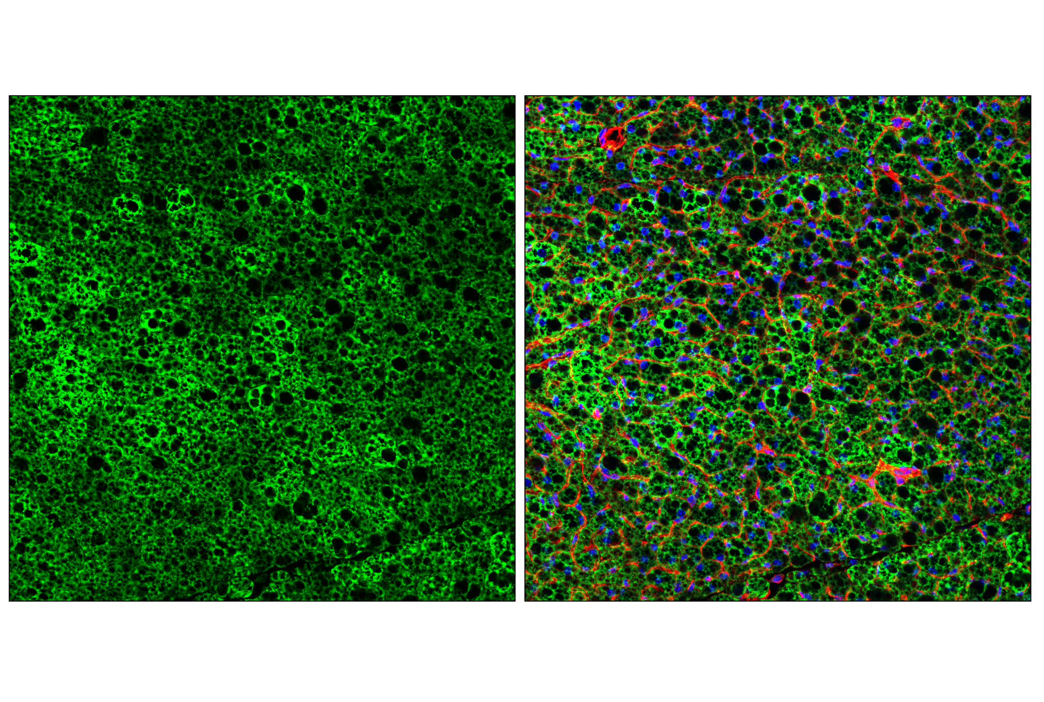 Immunofluorescence Image 2: SLC25A1 (E7B2B) Rabbit mAb