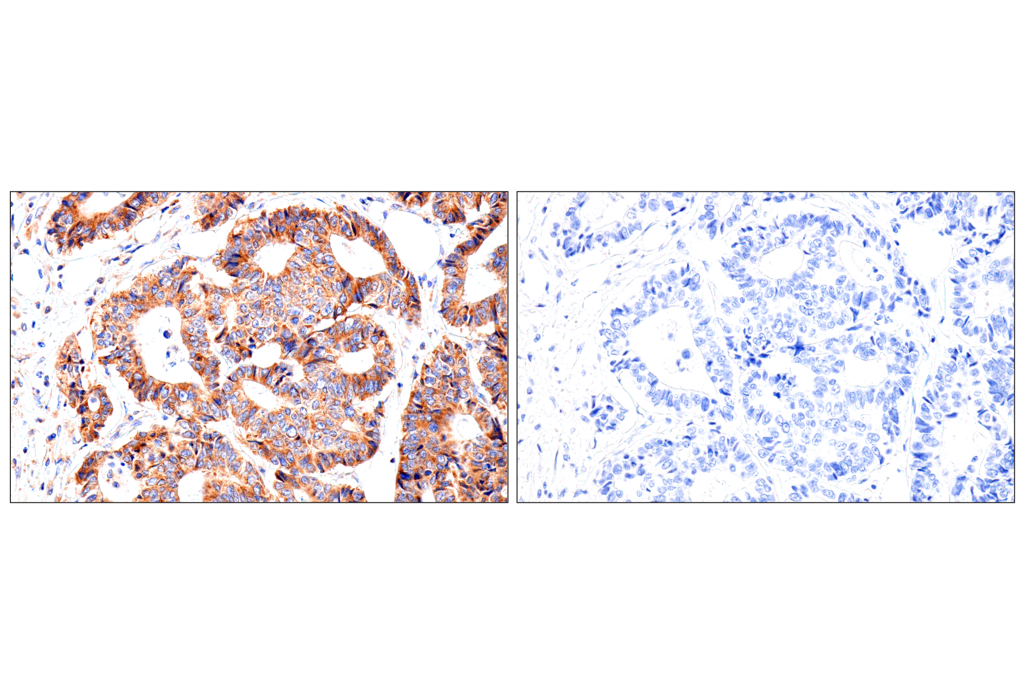 Immunohistochemistry Image 15: SLC25A1 (E7B2B) Rabbit mAb