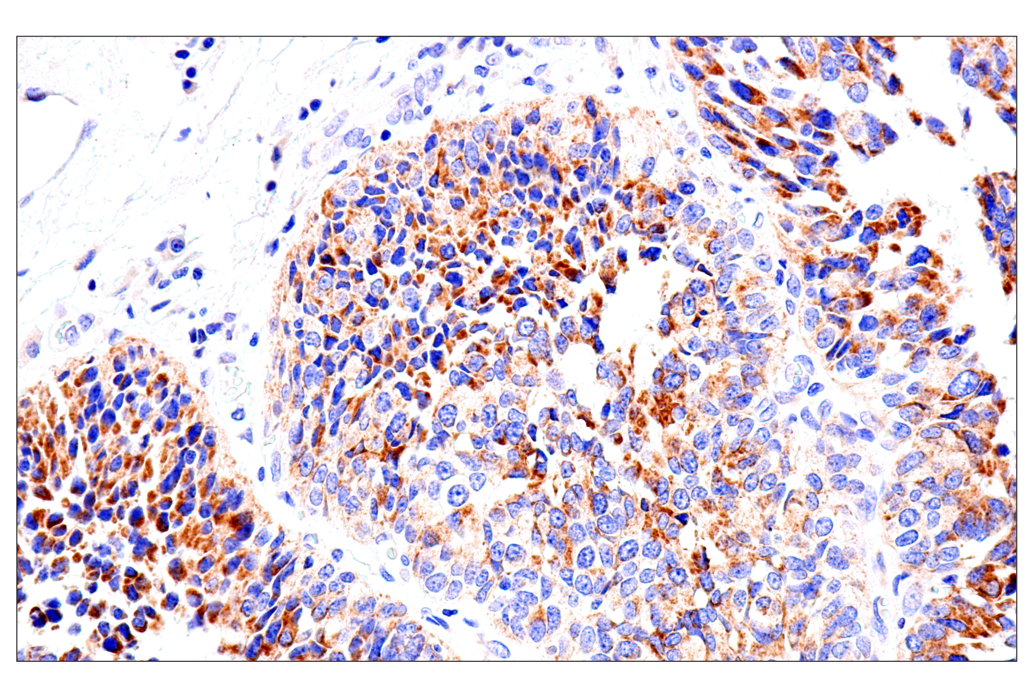 Immunohistochemistry Image 8: SLC25A1 (E7B2B) Rabbit mAb