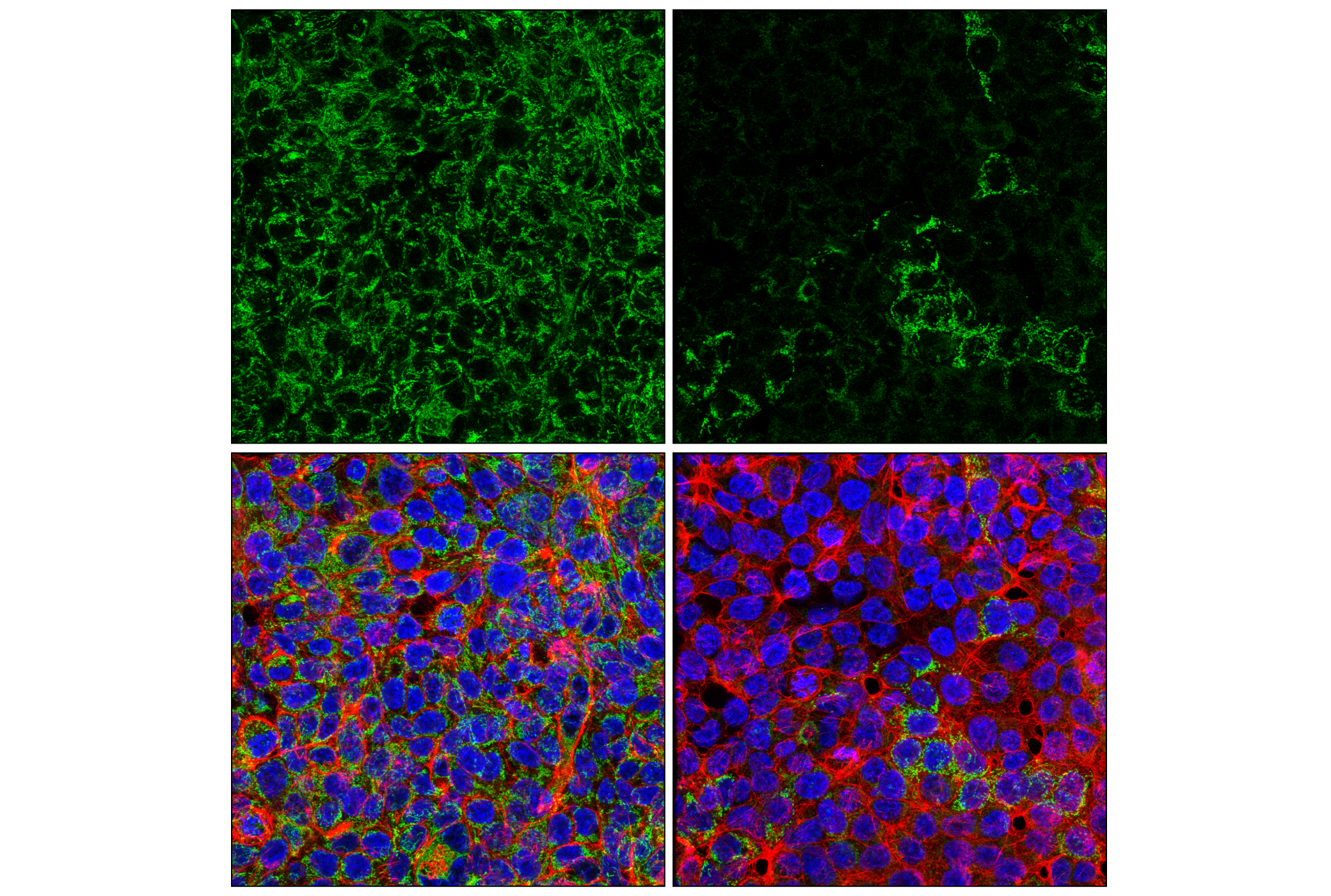 Immunofluorescence Image 3: SLC25A1 (E7B2B) Rabbit mAb