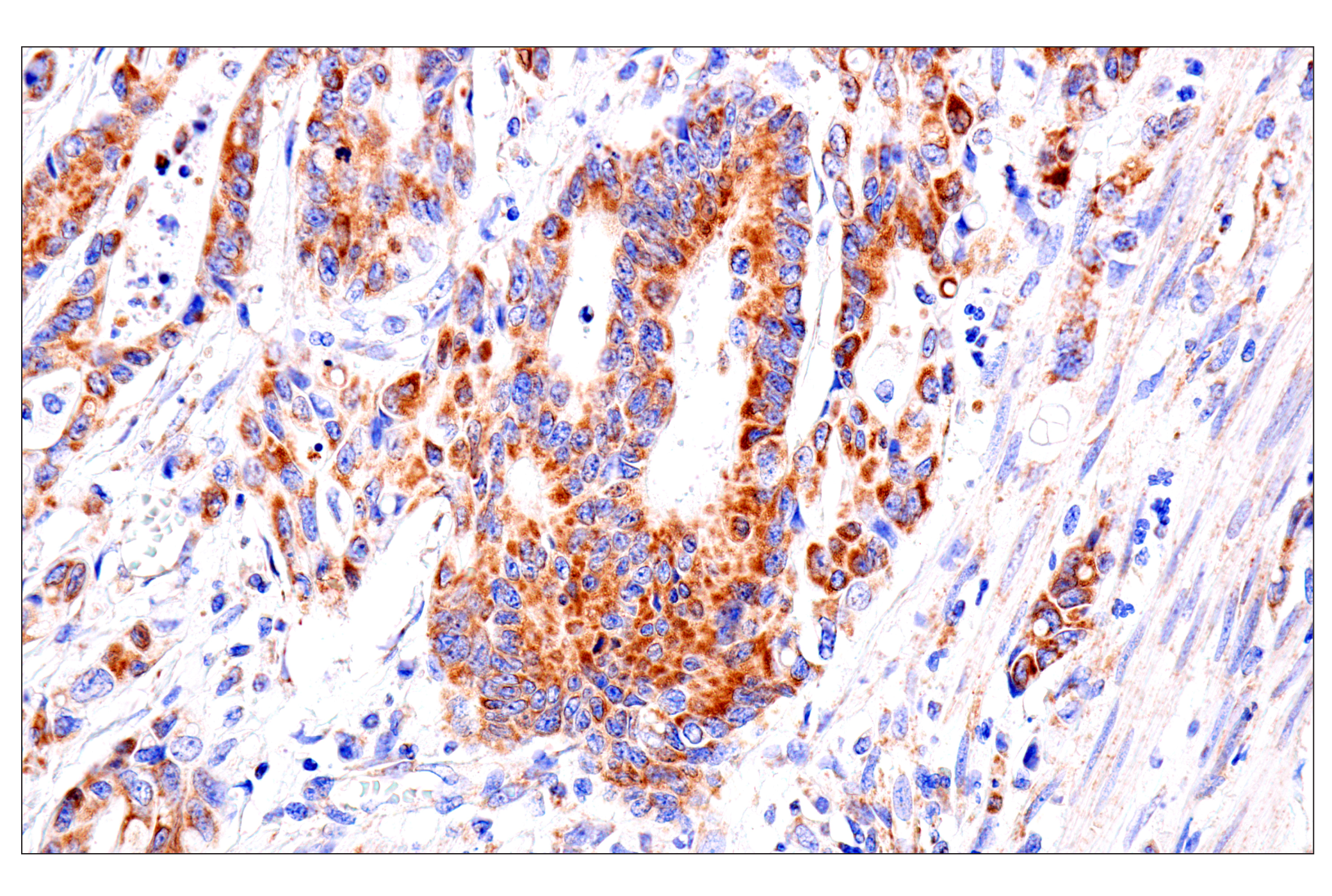 Immunohistochemistry Image 6: SLC25A1 (E7B2B) Rabbit mAb