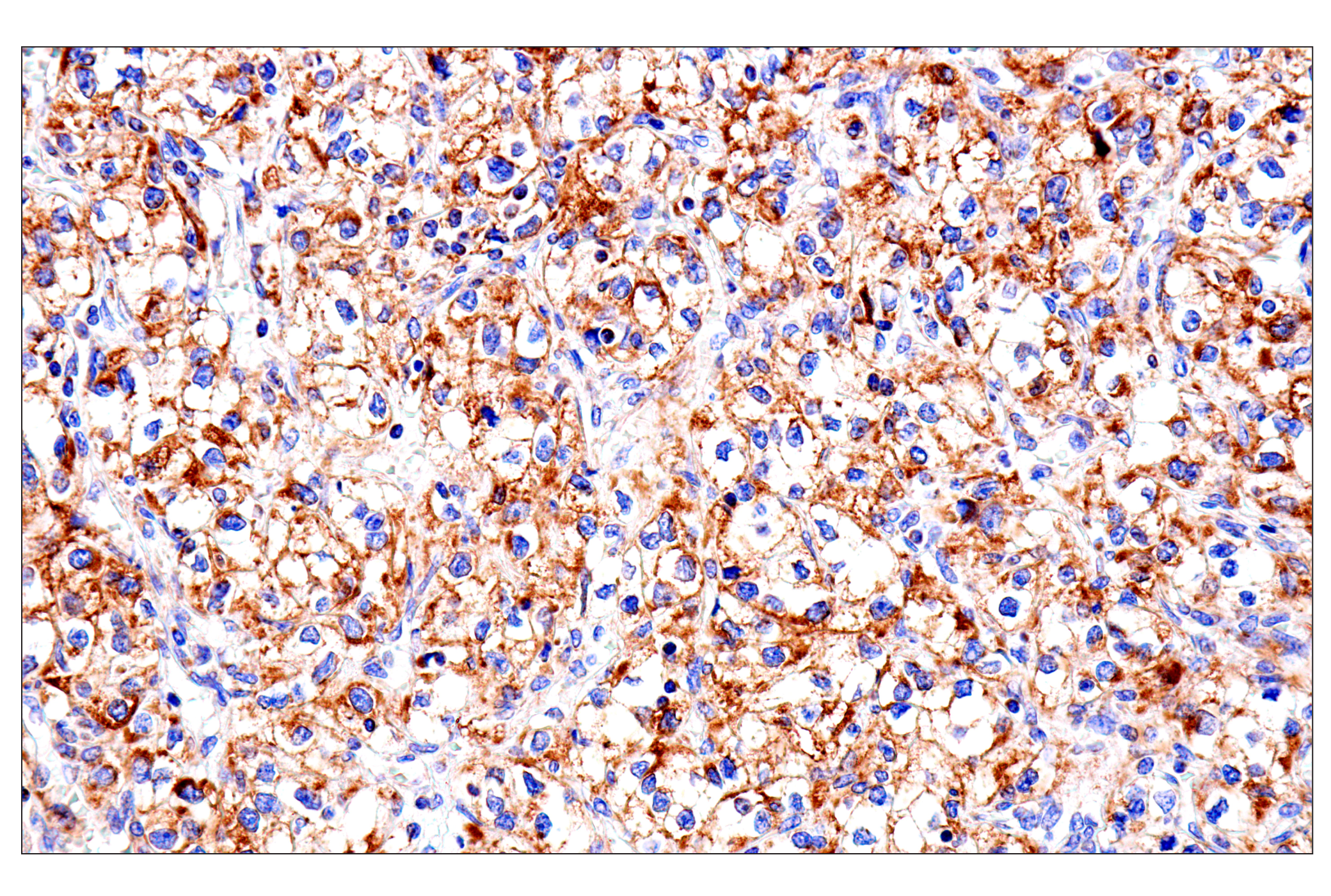 Immunohistochemistry Image 5: SLC25A1 (E7B2B) Rabbit mAb