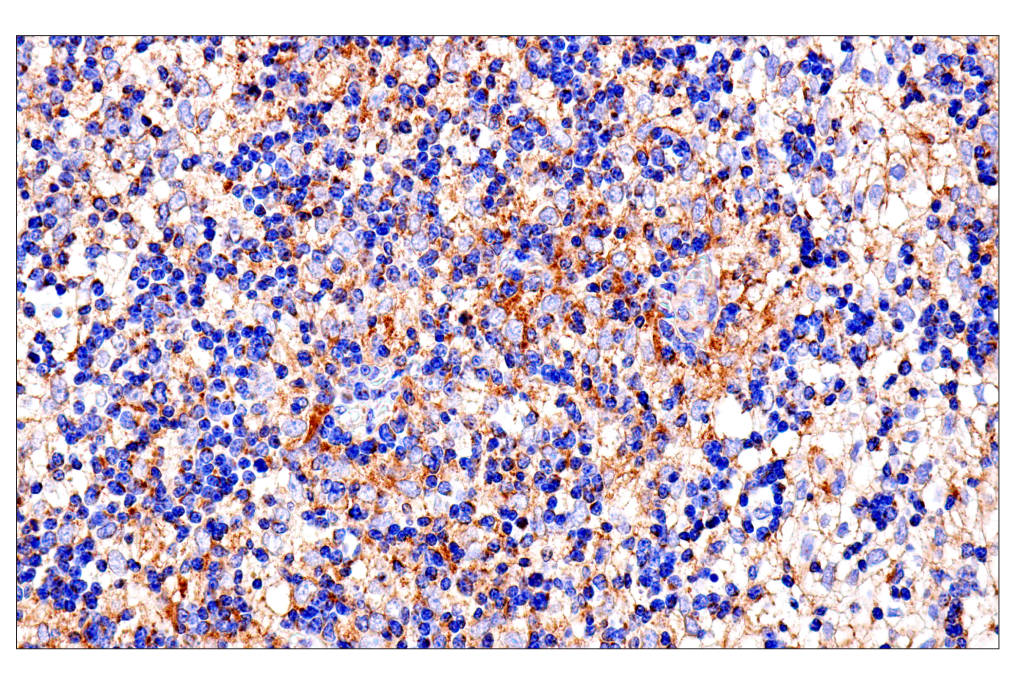 Immunohistochemistry Image 2: SLC25A1 (E7B2B) Rabbit mAb