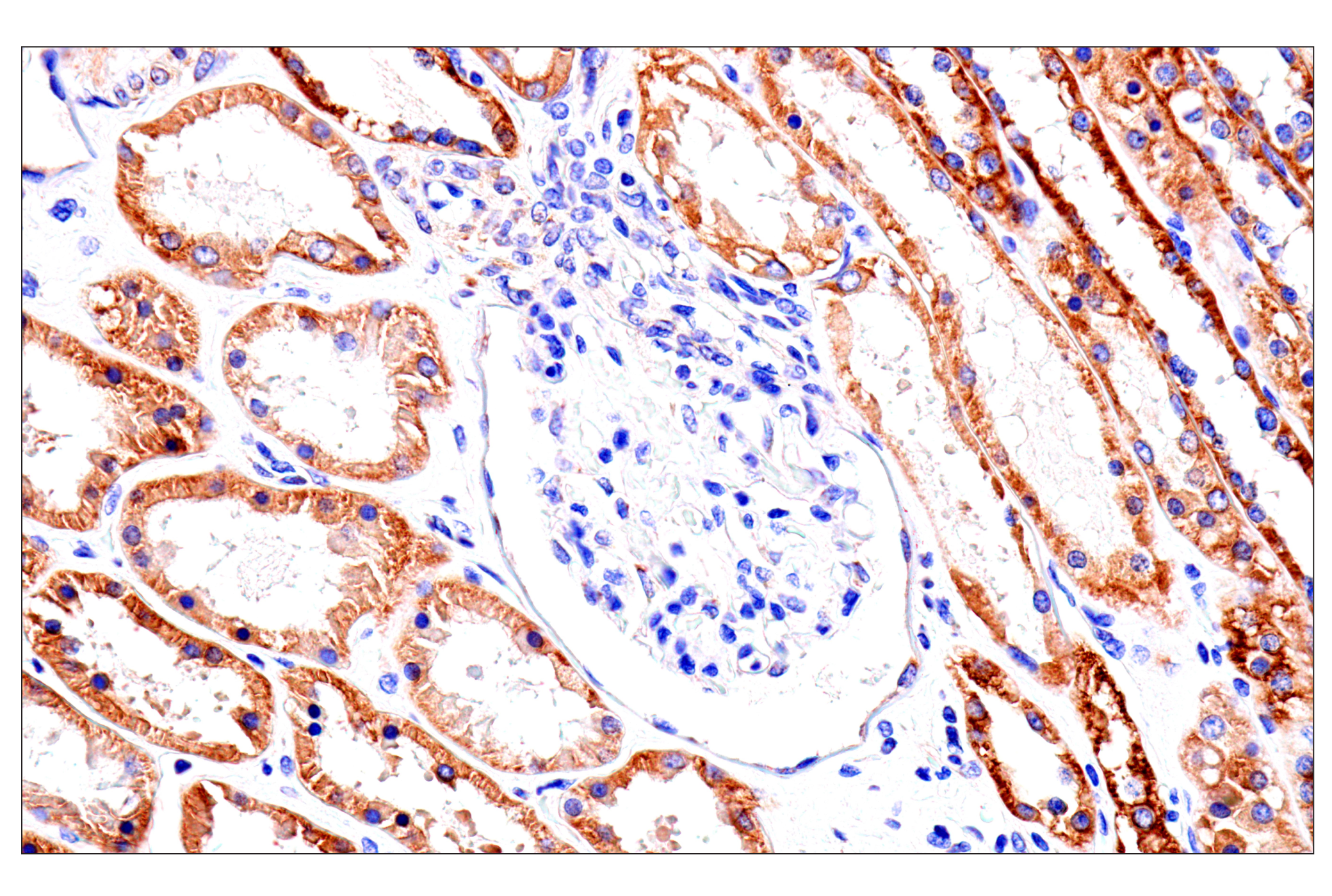 Immunohistochemistry Image 14: SLC25A1 (E7B2B) Rabbit mAb