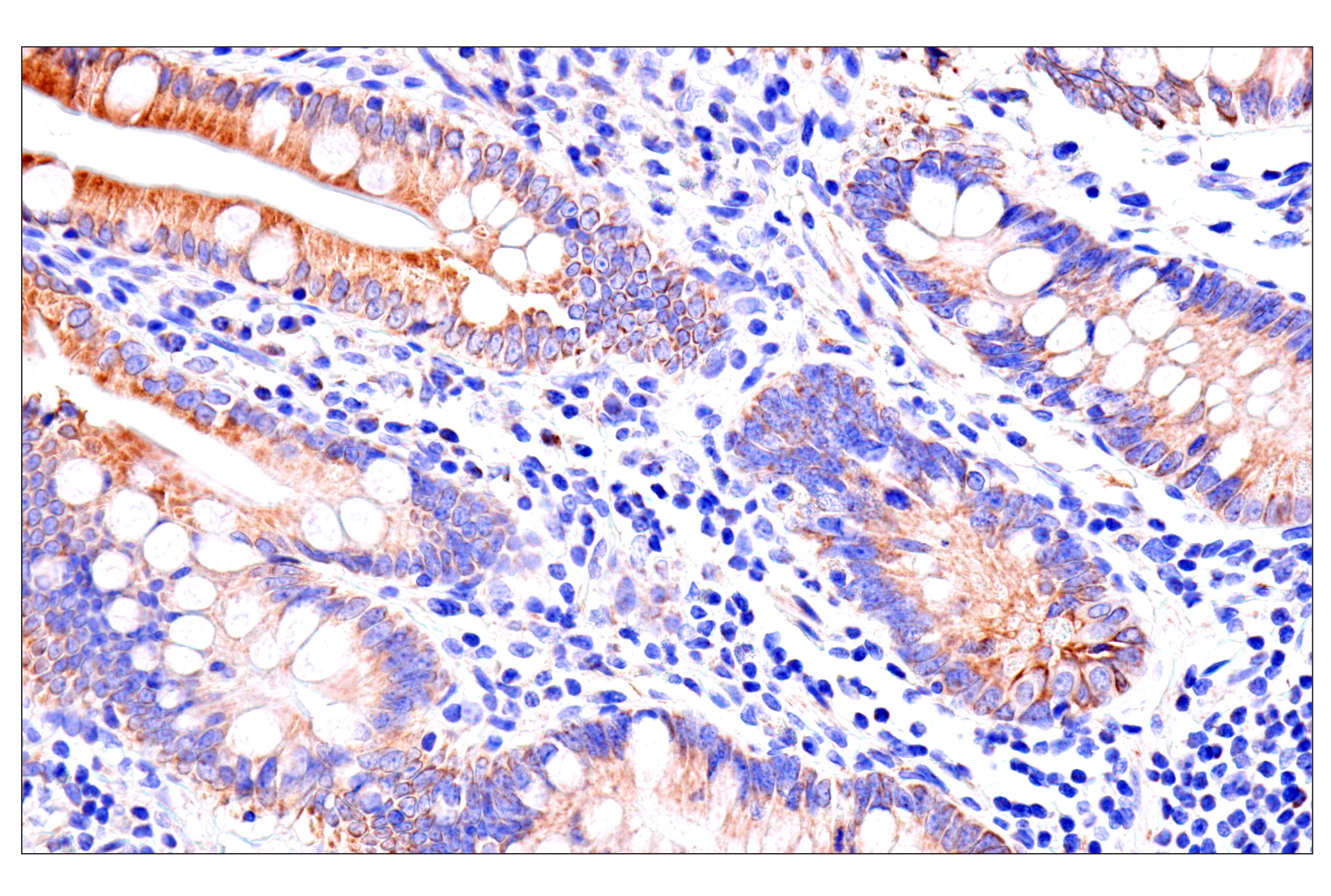 Immunohistochemistry Image 10: SLC25A1 (E7B2B) Rabbit mAb