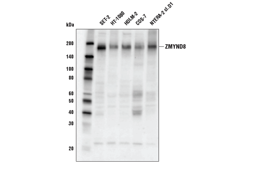 Western Blotting Image 1: ZMYND8 Antibody