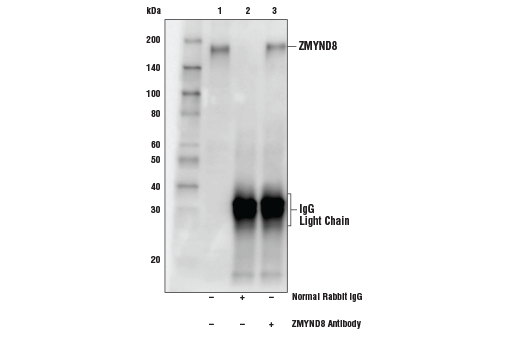 Immunoprecipitation Image 1: ZMYND8 Antibody
