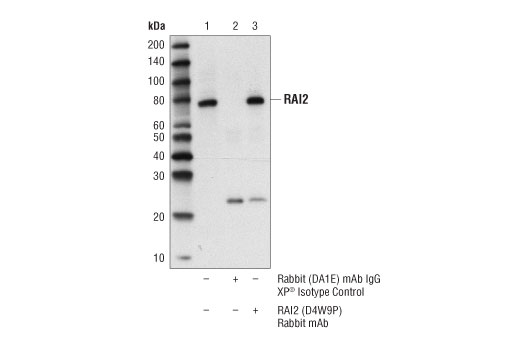 Immunoprecipitation Image 1: RAI2 (D4W9P) Rabbit mAb